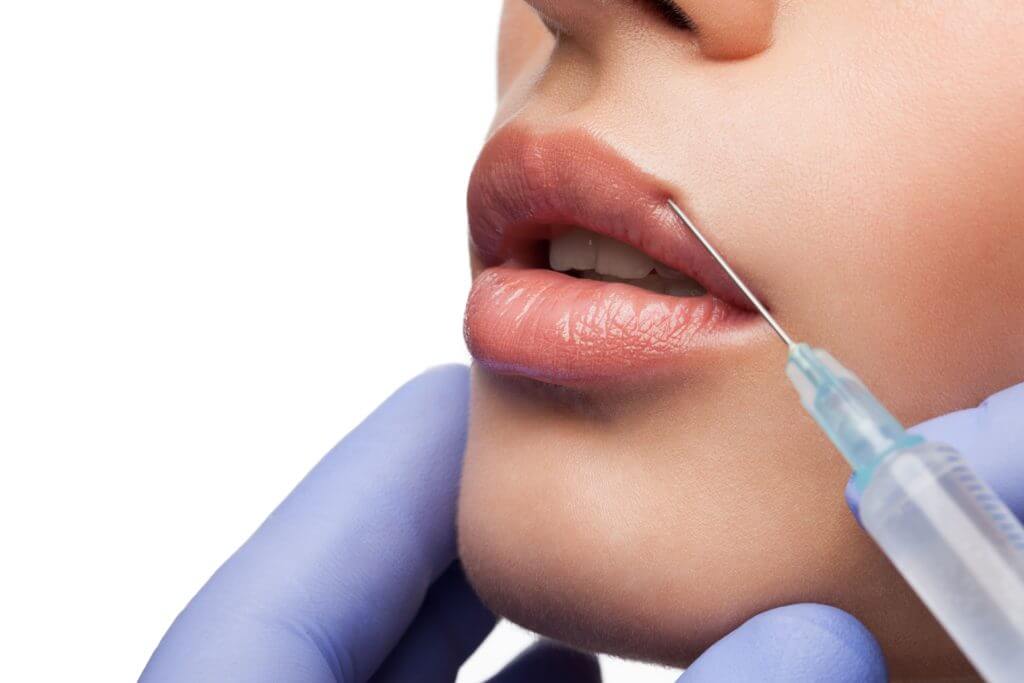 Woman Close Up Pose For Getting Lip Filler Injection | Auri Aesthetics in Gilbert, AZ