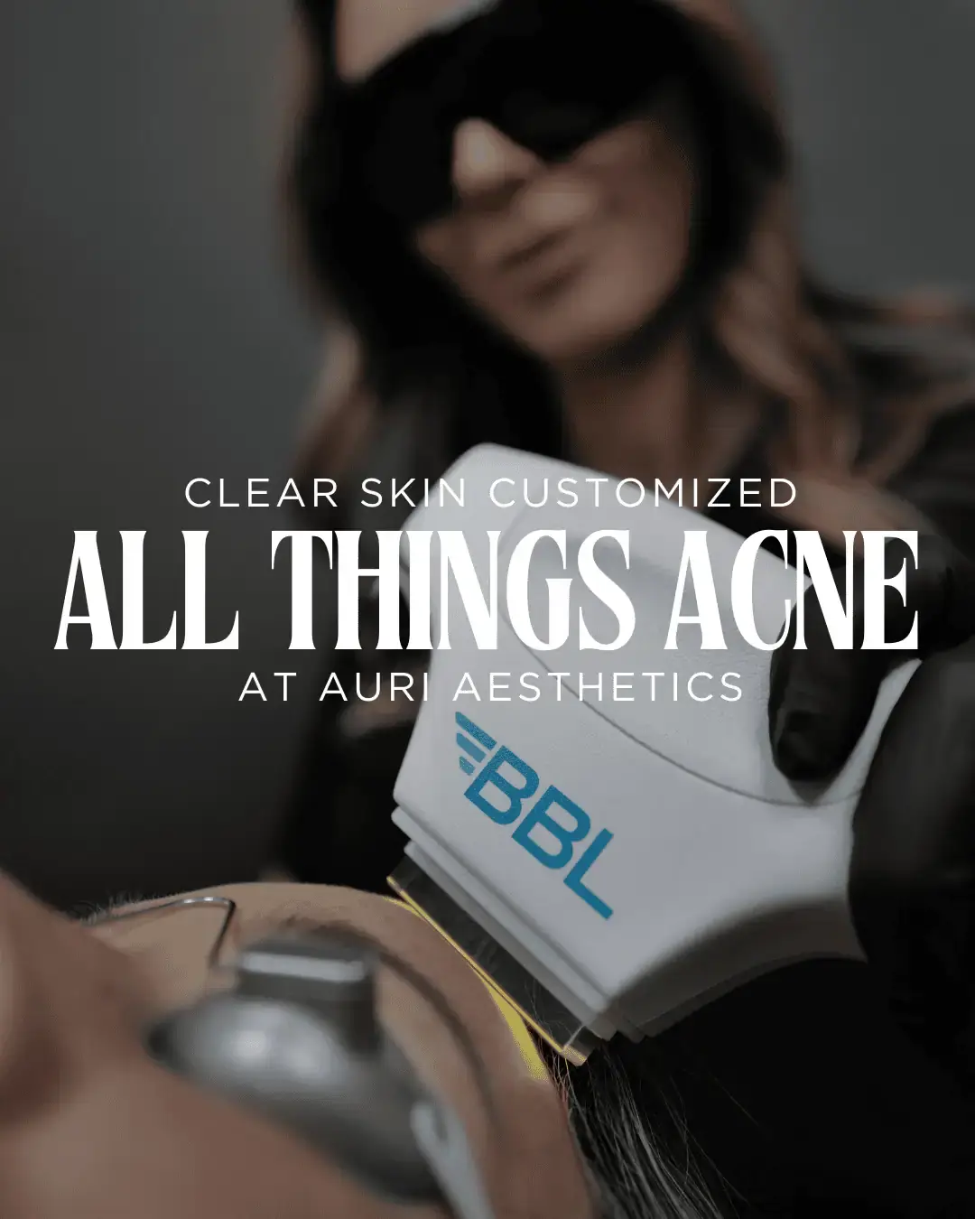 ACNE BLOG POST 1