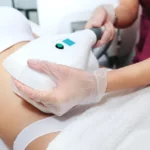 A woman receiving CoolSculpting® in Gilbert, AZ